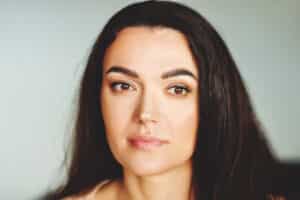 40-year-old woman has smooth forehead with elevated eyebrows thanks to brow lift techniques.